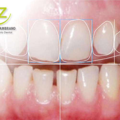 Diseno de Sonrisa con Dra. Cecilia Zambrano | Quito & Cumbaya