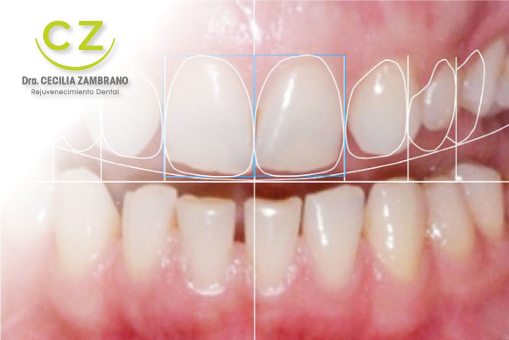 Diseno de Sonrisa con Dra. Cecilia Zambrano | Quito & Cumbaya