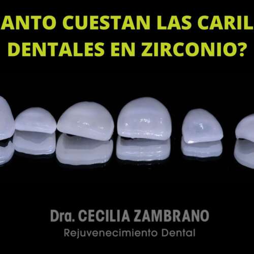 Carillas de Zirconio