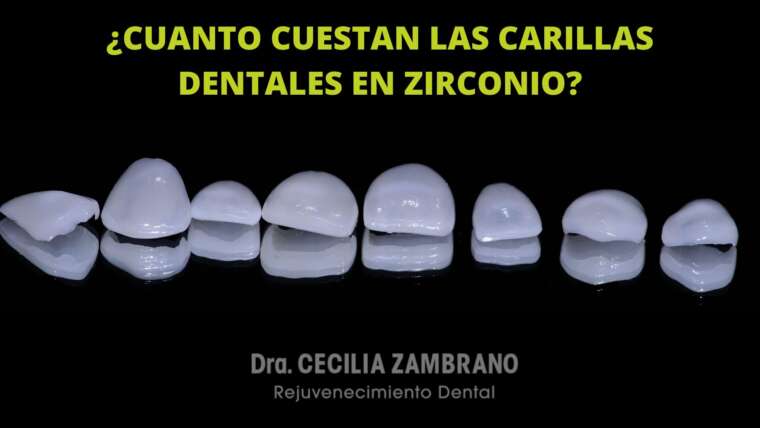 Carillas de Zirconio