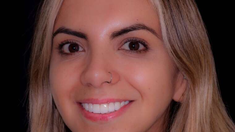 Mujer con sonrisa hermosa | Paciente Diseno de Sonrisa Quito Ecuador